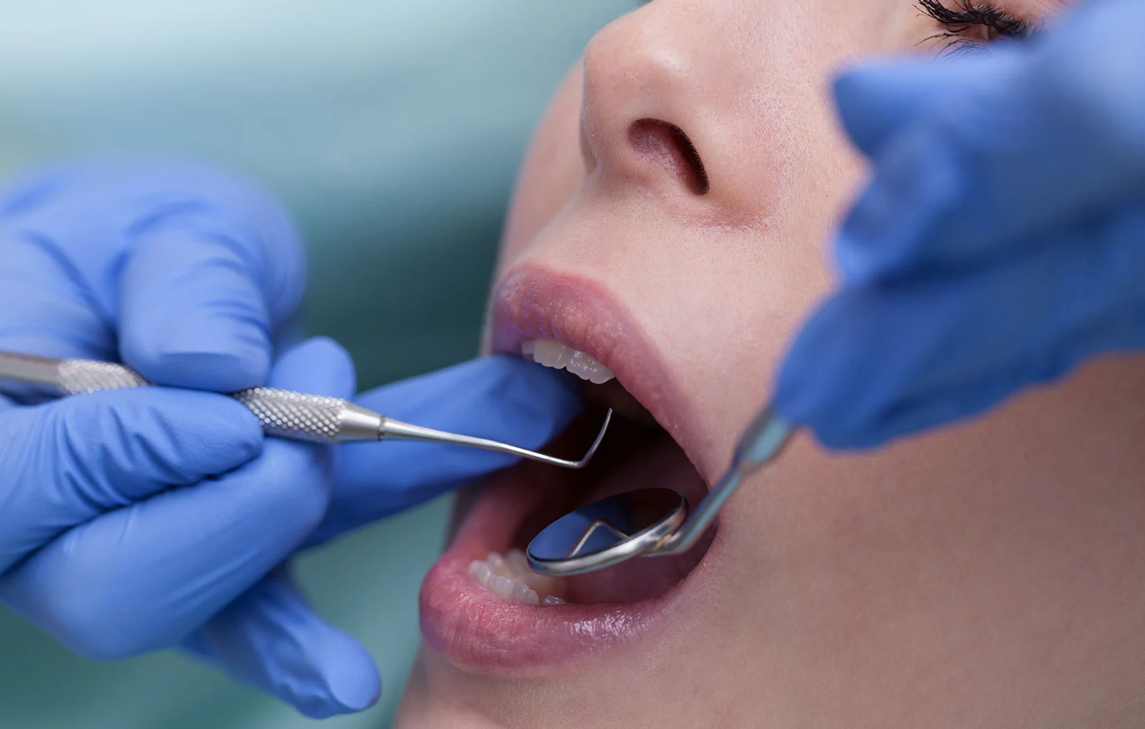 Checking patients dental filling